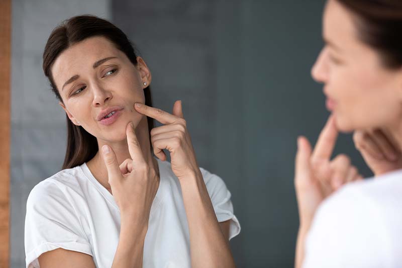 Les meilleurs produits de soins anti-acné