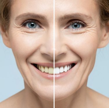 collagene-marin-ou-bovin-pour-votre-peau