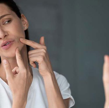 Les meilleurs produits de soins anti-acné Les meilleurs produits de soins anti-acné