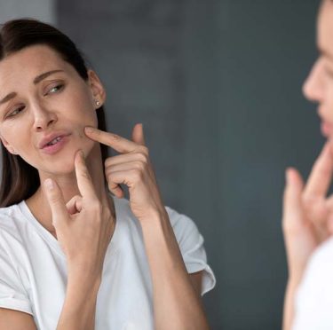 Les meilleurs produits de soins anti-acné Les meilleurs produits de soins anti-acné