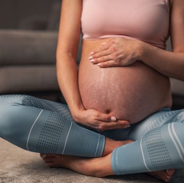 Vergetures grossesse : prévention et meilleurs remèdes